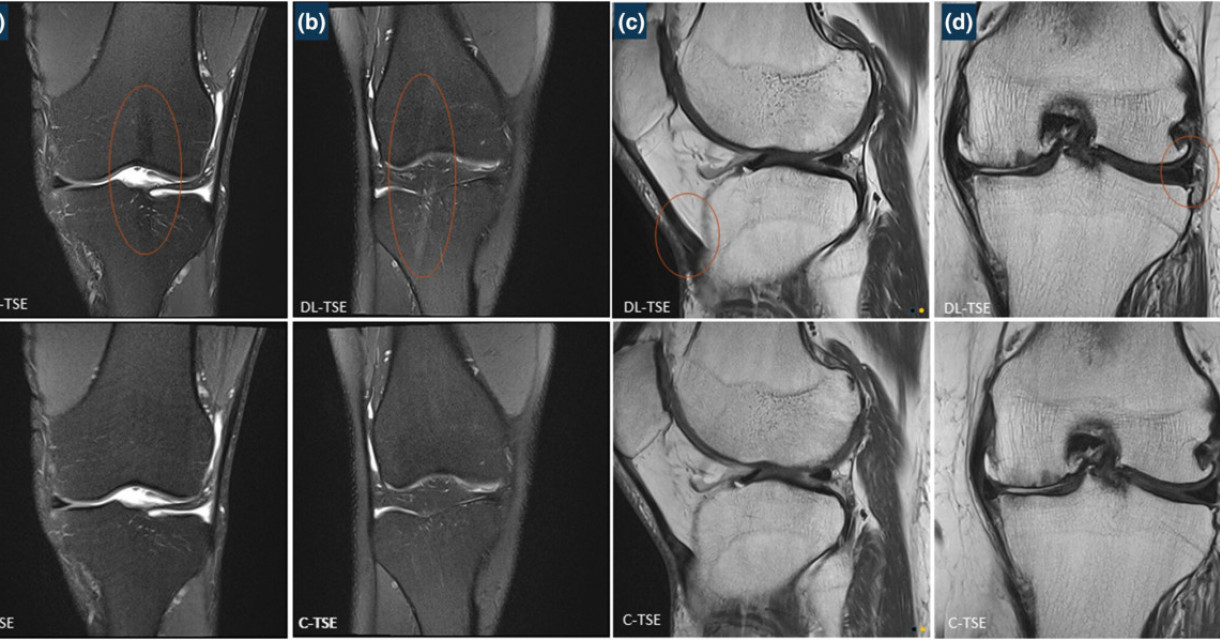 TSE Research images pt4bpt